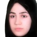 الهام رضازاده کارشناس بینایی سنجی و اپتومتری