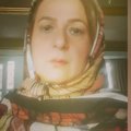 دکتر فرزانه محمدی فشارکی جراح دندانپزشک