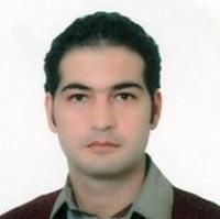 دکتر نوید قاسم بگلو متخصص چشمپزشکی